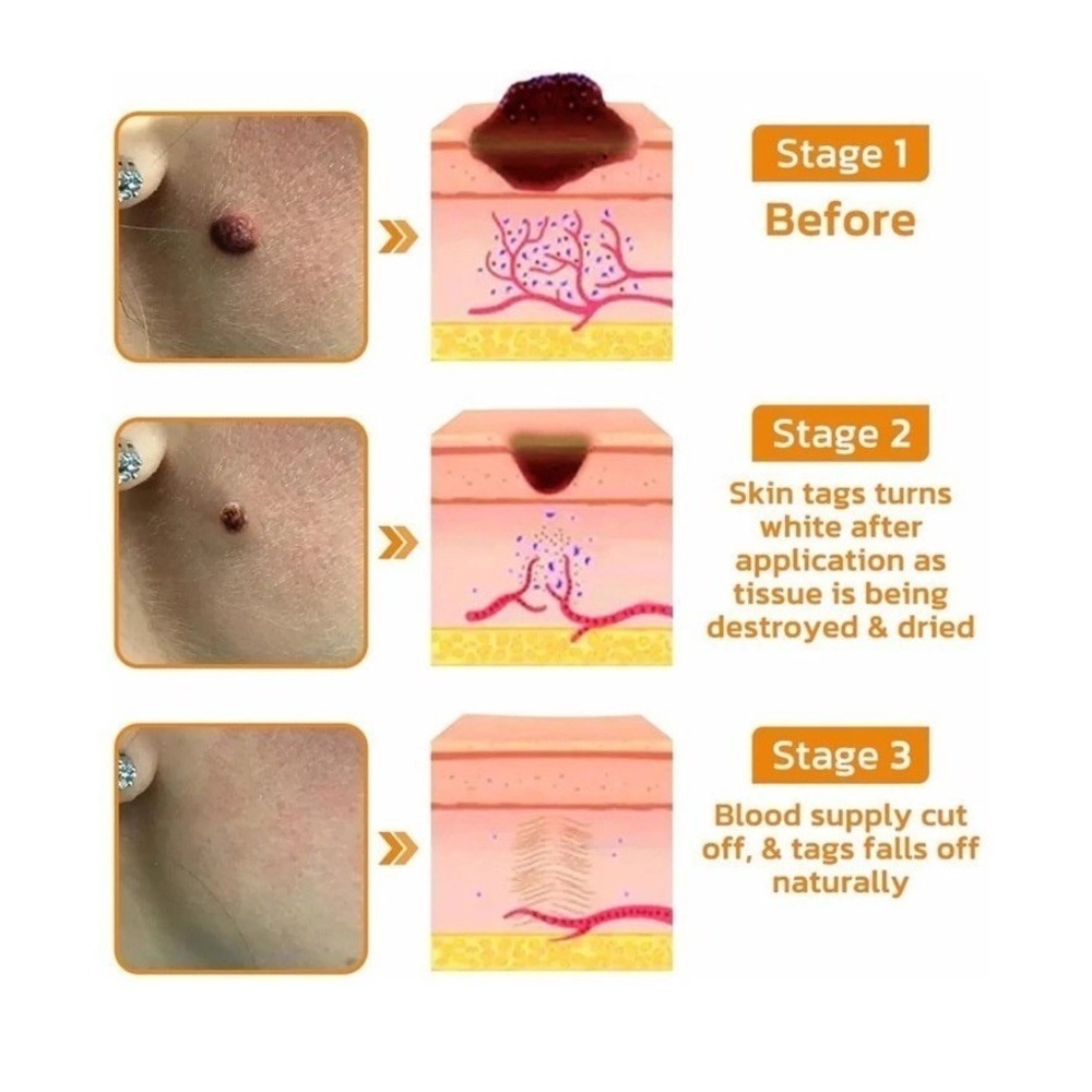 Bee Venom Skin Restoration Cream, Professional Bee Venom Skin Treatment Cream - Picture 3 of 9
